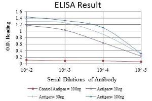 Red: Control Antigen (100 ng), Purple: Antigen (10 ng), Green: Antigen (50 ng), Blue: Antigen (100 ng), (GATA5 antibody)