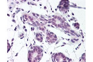 Immunohistochemistry (IHC) image for anti-ELAV (Embryonic Lethal, Abnormal Vision, Drosophila)-Like 1 (Hu Antigen R) (ELAVL1) (AA 1-13) antibody (ABIN307186)