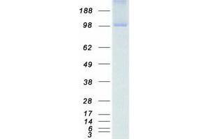 NEK9 Protein (Myc-DYKDDDDK Tag)