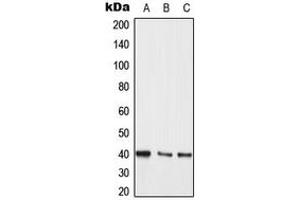 Western blot analysis of MKK3/6 expression in Jurkat (A), A431 (B), PC12 (C) whole cell lysates. (MKK3/6 (Center) antibody)