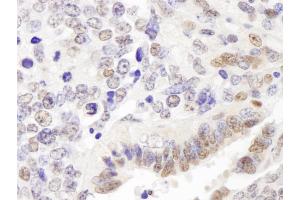 Immunohistochemistry (IHC) image for anti-GATA Zinc Finger Domain Containing 2A (GATAD2A) (AA 573-633) antibody (ABIN7448708)