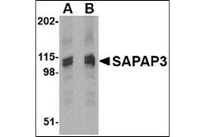 Western blot analysis of SAPAP3 in rat brain tissue lysate with this product at (A) 1 (B) 2 μg/ml.