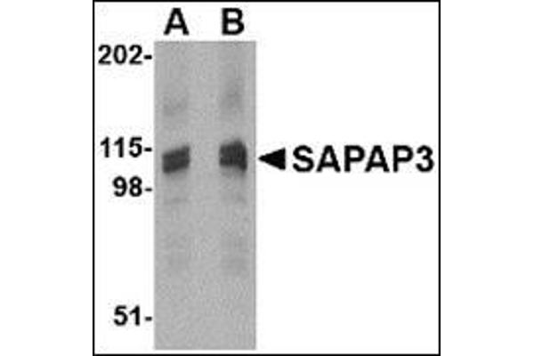 DLGAP3 anticorps  (C-Term)