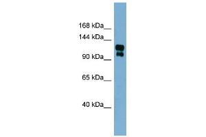 TRPA1 antibody used at 1 ug/ml to detect target protein. (TRPA1 antibody  (Middle Region))