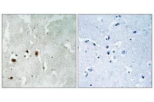 Immunohistochemistry analysis of paraffin-embedded human brain tissue using Tip60 (Phospho-Ser90) antibody. (KAT5 antibody  (pSer90))