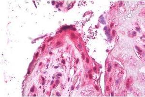 Anti-ACTRIIB / ACVR2B antibody IHC of human placenta, trophoblast.