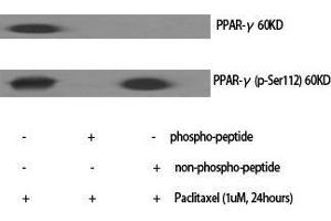 Western Blot (WB) analysis of specific cells using PPAR-gamma Polyclonal Antibody. (PPARG antibody  (Thr2638))