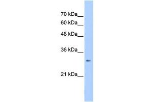WB Suggested Anti-ING1 Antibody Titration:  2. (ING1 antibody  (C-Term))