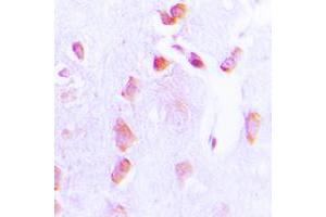 Immunohistochemical analysis of BCL2 (pT69) staining in human brain formalin fixed paraffin embedded tissue section. (Bcl-2 antibody  (pSer69))