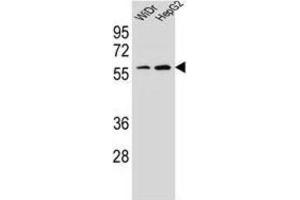 Western Blotting (WB) image for anti-Homeobox A10 (HOXA10) antibody (ABIN2995594)