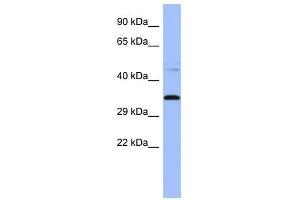 PYCR1 antibody used at 1 ug/ml to detect target protein.