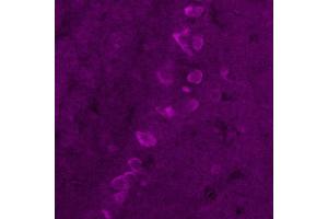 Immunohistochemistry (IHC) image for anti-Corticotropin Releasing Hormone (CRH) antibody (ABIN7456207) (CRH antibody)