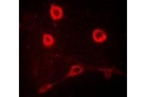 Immunofluorescent analysis of CD212 staining in MCF7 cells. (IL12RB1 antibody)