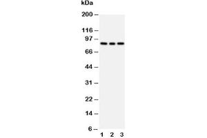 Western blot testing of PI3K antibody and Lane 1:  rat testis;  2: 293T;  3: HeLa cell lysate
