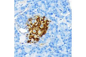 Immunohistochemistry of paraffin-embedded rat pancreatic islet using Insulin Rabbit mAb (ABIN7267886) at dilution of 1:100 (40x lens). (Insulin antibody)