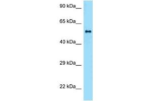 WB Suggested Anti-Zbtb37 Antibody   Titration: 1. (ZBTB37 antibody  (Middle Region))