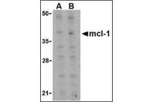 Western blot analysis of Mcl-1 in Raji cell lysates with this product at (A) 1 and (B) 2 μg/ml.