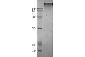 Validation with Western Blot (CEACAM1 Protein (Transcript Variant 2) (His tag))