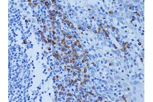 Immunohistochemistry of paraffin-embedded human tonsil using ATG7 antibody. (ATG7 antibody)