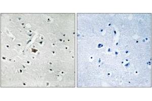 Immunohistochemistry analysis of paraffin-embedded human brain, using PLD2 (Phospho-Tyr169) Antibody. (Phospholipase D2 antibody  (pTyr169))