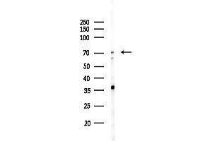 anti-Hepatocyte Growth Factor Activator (HGFA) (C-Term) antibody