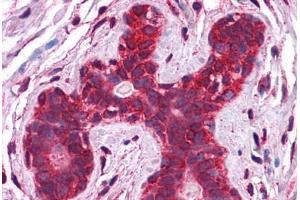 Human Breast: Formalin-Fixed, Paraffin-Embedded (FFPE) (Calreticulin antibody  (AA 342-391))