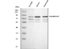 Western blot analysis of PAK5 using anti-PAK5 antibody (ABIN3043895). (PAK7 antibody  (N-Term))