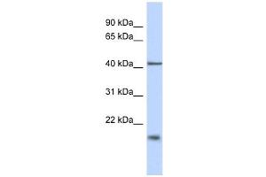 TBC1D21 antibody used at 1 ug/ml to detect target protein.
