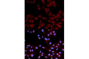 Immunofluorescence analysis of U2OS cells using Phospho-MAPK14-Y182 antibody (ABIN5969911). (MAPK14 antibody  (pTyr182))