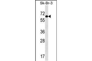 Western blot analysis in SK-BR-3 cell line lysates (35ug/lane). (TRIP4 antibody  (AA 194-222))