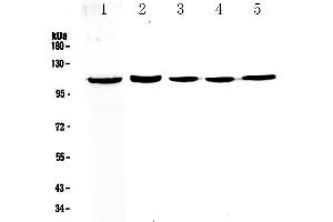 Western blot analysis of CP110 using anti-CP110 antibody . (CP110 antibody  (AA 51-284))
