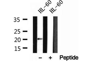 Western blot analysis of extracts of HL-60 cells, using Centrin 1 antibody. (Centrin 1 antibody  (Internal Region))