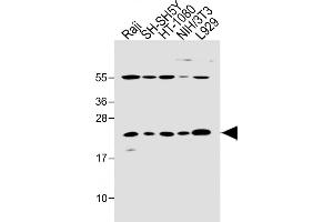 All lanes : Anti-Bax Antibody (BH3 Domain Specific) at 1:2000 dilution Lane 1: Raji whole cell lysate Lane 2: SH-SH5Y whole cell lysate Lane 3: HT-1080 whole cell lysate Lane 4: NIH/3T3 whole cell lysate Lane 5:  whole cell lysate Lysates/proteins at 20 μg per lane. (BAX antibody  (AA 41-76))