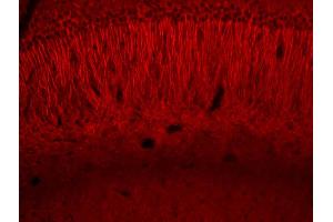 Generously provided by Merlin Levine from National Institutes of Health as part of the Bioss Discovery Program. (HSP70 antibody  (AA 481-534))