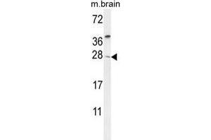 TIMP4 Antibody (Center) western blot analysis in mouse brain tissue lysates (35 µg/lane). (TIMP4 antibody  (Middle Region))