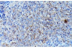 Immunohistochemistry of paraffin-embedded Rat spleen using CSF3 Polyclonal Antibody at dilution of 1:100 (40x lens). (G-CSF antibody)