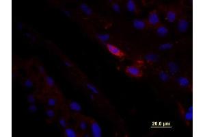 Formalin-fixed and paraffin embedded Human testis tissue labeled with unconjugated Anti-CD163/M130 Polyclonal Antibody, unconjugated  at 1:100 for 40 minutes at 37°C followed by labeling Donkey Anti-Rabbit, Cy3 conjugated 1:300, 60 minutes at 37°C.