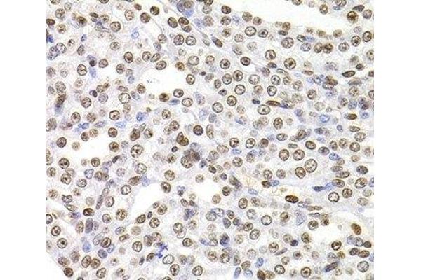 SOX5 antibody