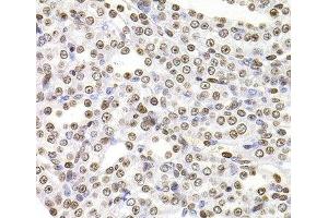 Immunohistochemistry of paraffin-embedded Rat kidney using SOX5 Polyclonal Antibody at dilution of 1:100 (40x lens).