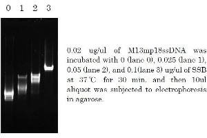 Polymerase Chain Reaction (PCR) image for Sjogren Syndrome Antigen B (SSB) (Active) protein (ABIN2452175)