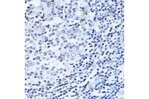 Immunohistochemistry of paraffin-embedded human appendix using PARP1 antibody. (PARP1 antibody  (AA 81-390))