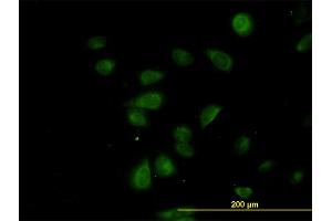 Immunofluorescence of monoclonal antibody to CDK5RAP3 on HeLa cell. (CDK5RAP3 antibody  (AA 1-506))