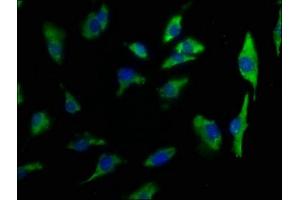 Immunofluorescence staining of U251 cells with ABIN7140189 at 1:50, counter-stained with DAPI. (Transmembrane Protein 131-Like (TMEM131L) (AA 963-978) antibody)