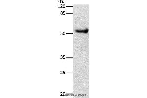 Western blot analysis of Human liver cancer tissue, using DRD4 Polyclonal Antibody at dilution of 1:600 (DRD4 antibody)