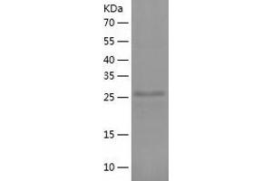 Western Blotting (WB) image for Translin-Associated Factor X (TSNAX) (AA 1-290) protein (His tag) (ABIN7125469) (TSNAX Protein (AA 1-290) (His tag))