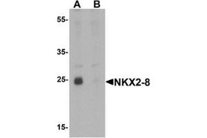 Western blot analysis of NKX2-8 in rat liver tissue lysate with NKX2-8 antibody at 1 ug/mL in (A) the absence and (B) the presence of blocking peptide (NKX2-8 antibody  (Middle Region))