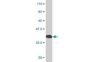 Western Blot detection against Immunogen (37. (ZNF133 antibody  (AA 121-230))