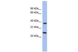 MTRF1L antibody used at 1 ug/ml to detect target protein. (MTRF1L antibody  (N-Term))