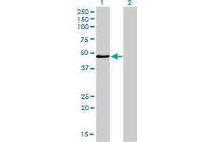 Western Blot analysis of IRF4 expression in transfected 293T cell line by IRF4 monoclonal antibody (M05), clone 2D1. (IRF4 antibody  (AA 342-451))