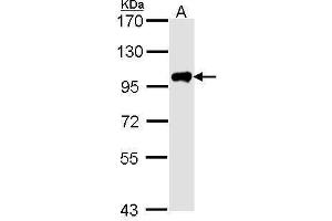 WB Image Sample (30 ug of whole cell lysate) A: Hela 7. (Calpain 3 antibody  (C-Term))